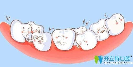 阜阳贝得口腔做成人牙齿矫正和儿童牙齿矫正有什么不同？