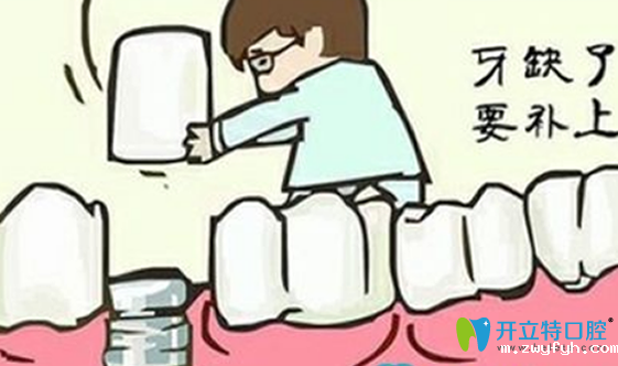 拔牙后多久可以镶牙？拔牙后镶牙有没有时间？