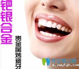 钯银烤瓷牙好不好?银钯合金烤瓷牙优缺点及价格和图片介绍