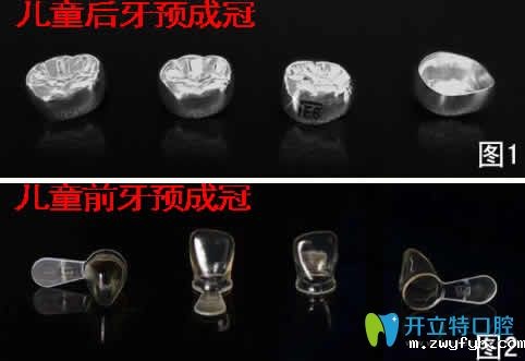 儿童预成冠对牙齿有没有危害及戴预成冠后注意事项的详解