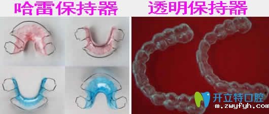 哈雷保持器和透明保持器哪种好？看两种保持器的优势区别