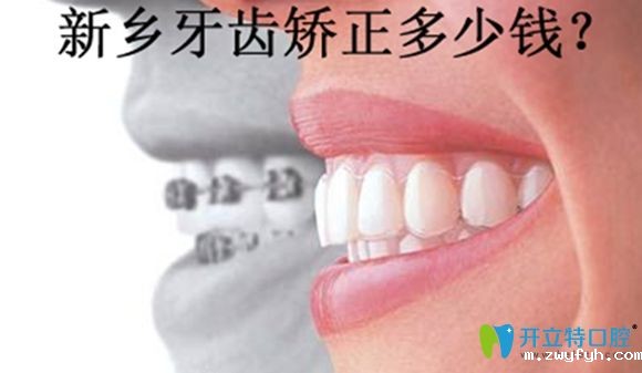 新乡牙齿矫正价格表暂以拜博口腔收费价格为示例来参考