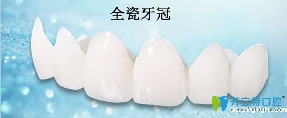 全瓷牙冠展示图