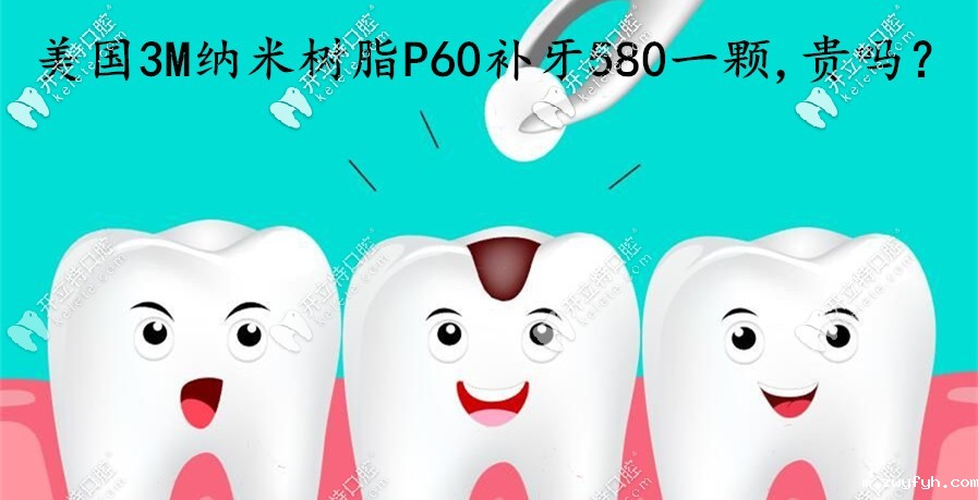 在烟台做美国3MP60纳米树脂补牙580一颗，这费用算贵吗