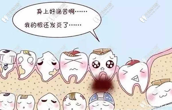 再和你聊聊发炎和干槽症的区别？干槽症前兆是啥样？