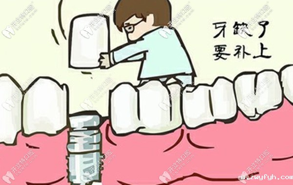 潮州地区种植牙大概多少钱一颗,韩系/欧美种牙系统价格全了